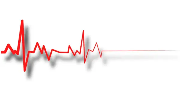 CDC Slowly dying - declining heartbeat
